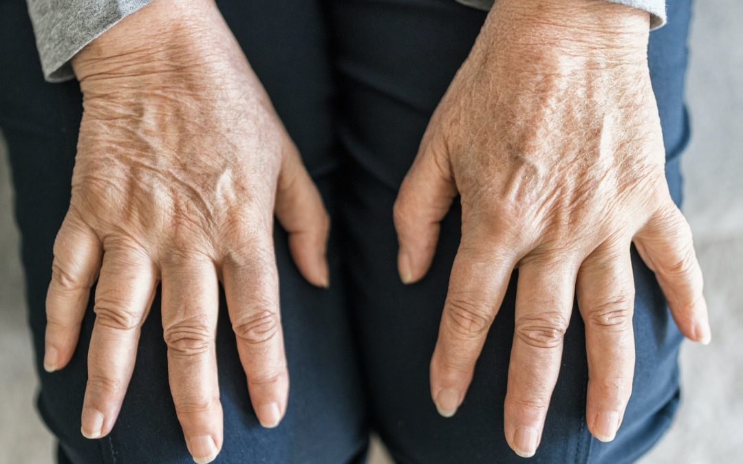 Senior woman suffering from arthritis