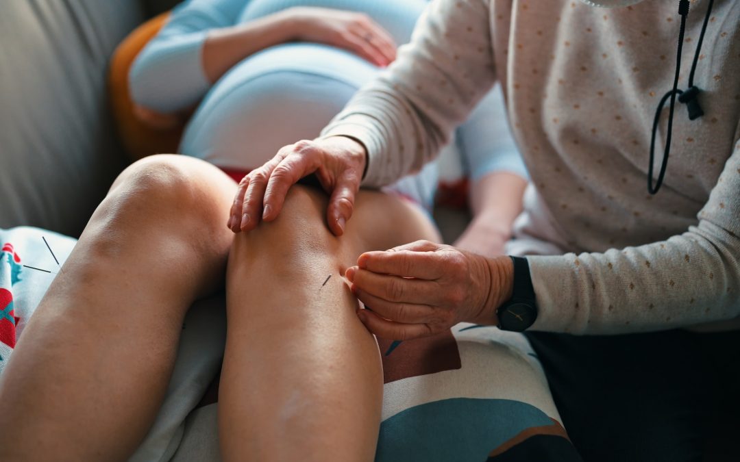 Pregnant woman getting acupuncture treatment